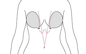 ヌーブラつけ方・ホックがおへそを向くように