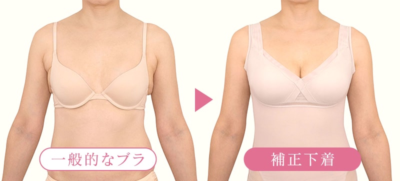 一般的なブラと補正下着の違い